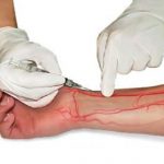 Kỹ Thuật Lấy Máu Động Mạch 1