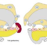 Phác Đồ Hướng Dẫn Điều Trị Ung Thư Dạ Dày 2