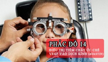 Phác Đồ Điều Trị Tiêm Chất Ức Chế Vegf Vào Dịch Kính (Avastin)