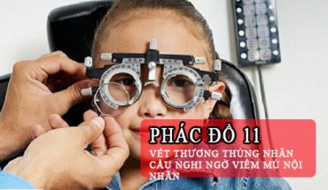 Phác Đồ Điều Trị Vết Thương Thủng Nhãn Cầu Nghi Ngờ Viêm Mủ Nội Nhãn
