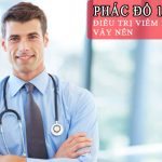 Điều Trị Viêm Khớp Vảy Nến
